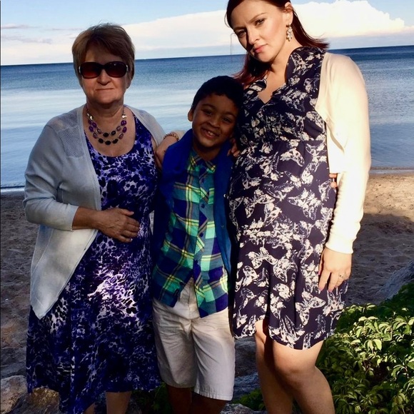 Maternity summer dress - Picture 3 of 3